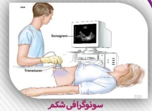 تروما چیست؟