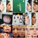 دکتر بتول سادات سجادی نژاد متخصص جراحی گوش،حلق،بینی وجراحی زیبایی در بیرجند