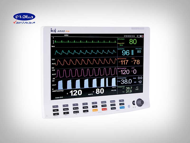 مانیتور علائم حیاتی Cardioset ARAD P10 با نمایش علائم مختلف حیاتی در شرکت صنعت تجهیزات پزشکی صاایران