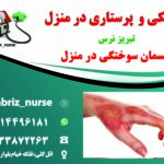 درمان زخم بستر به روش پانسمان نوین در تبریز