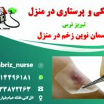 درمان زخم بستر به روش پانسمان نوین در تبریز